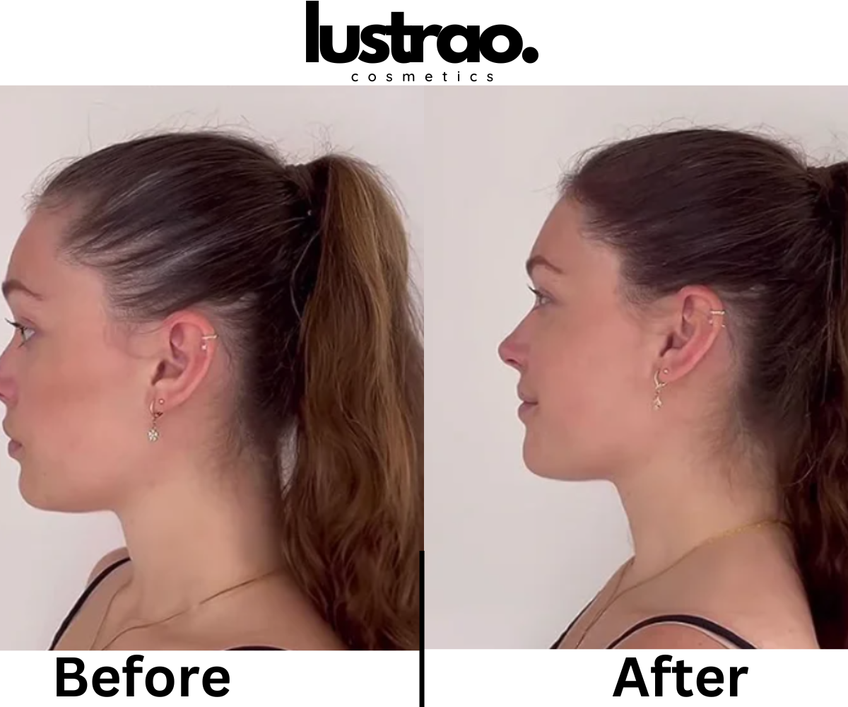 Lustrao Hair regrowth oil-3